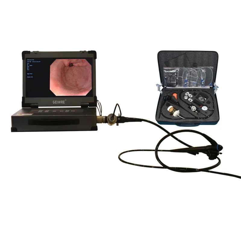 olympus endoscope Video Endoscopy Equipment Gastroscope and Colonoscope System portable 1080p  endoscopy camera