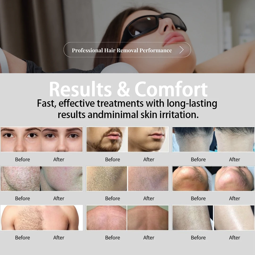 2026 Newest High Power 3 Years Warranty Diode Laser 808 nm Ice Cooling 4 Wavelength Laser Diode Laser Hair Removal Machine Price