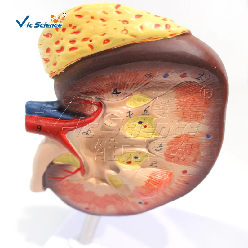 Почечная анатомическая модель нефроновая гломерулярная