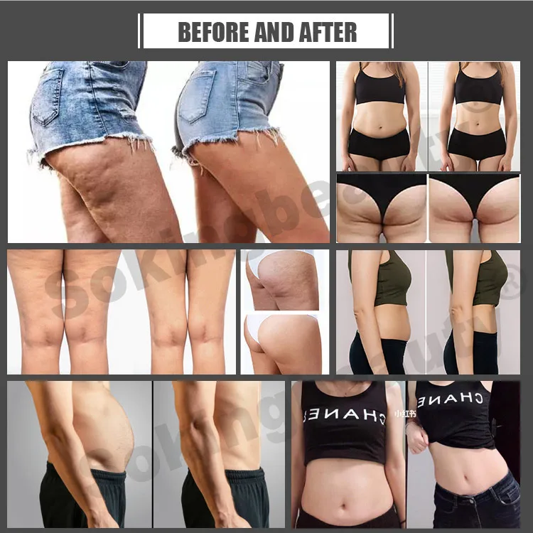 Professional Presoterapia Air Pressure Suit Compression Leg Full Body Massager Pressotherapy Lymphatic Drainage Beauty Center