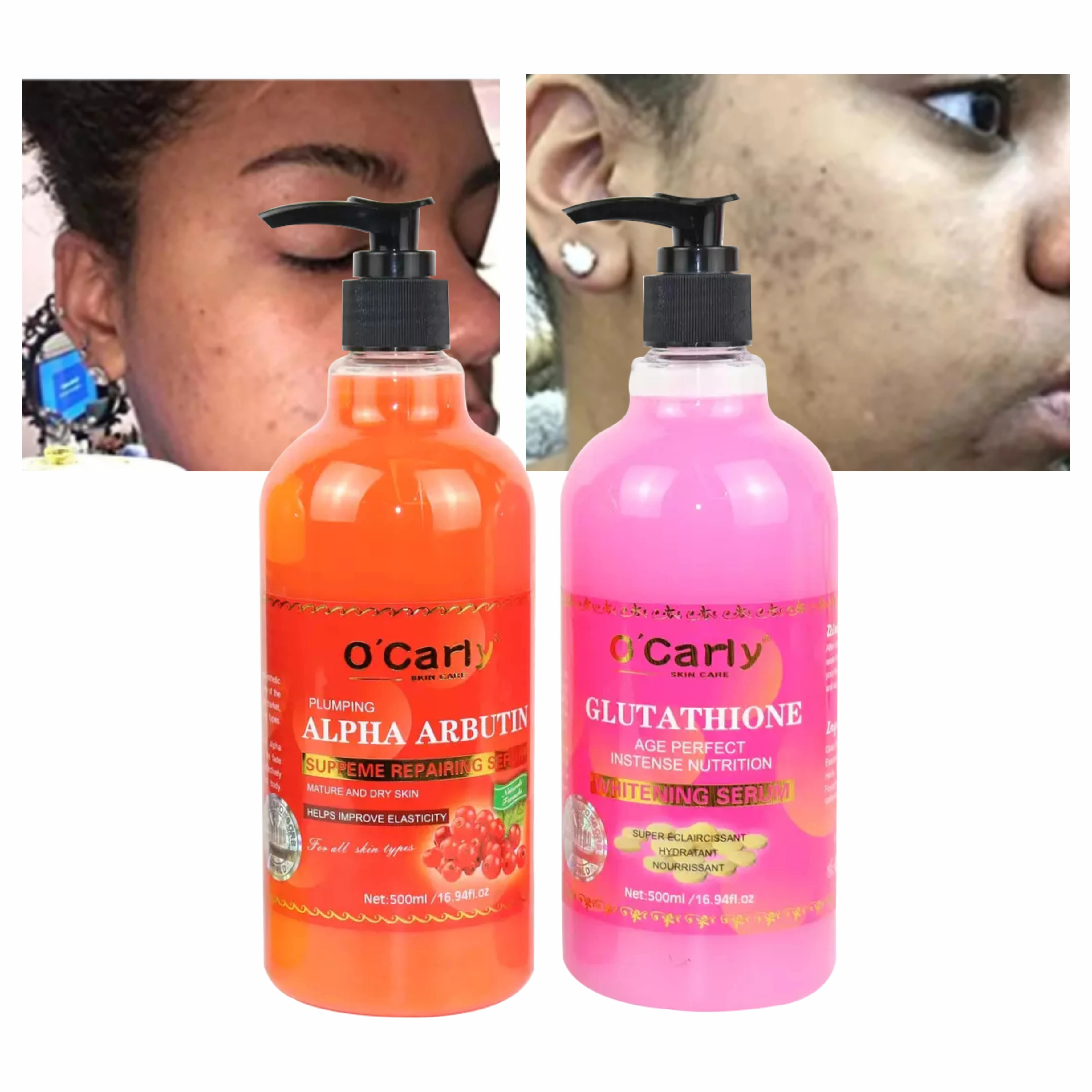 OEM Arbutin Ordinary Anti-Aging Whitening Bleaching Repairing Hyaluronic  Acid Serum Liquid Face African Skin 500ml Vitamin C