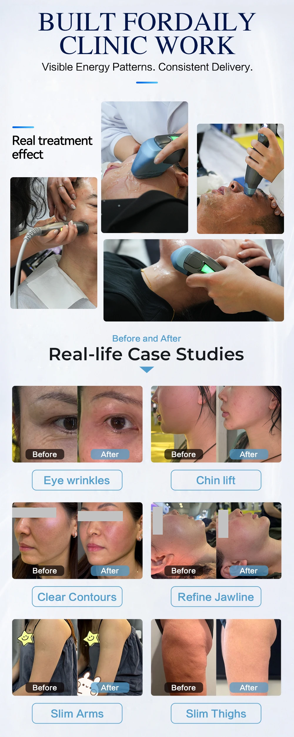 <p data-pm-slice="1 1 []">The 3-in-1 Titanium HIFU, RF & Ultrasound Skin Rejuvenation Machine combines Titanium Ultrasound HIFU, Vmax Multi-Shot HIFU, and Thermage-style RF technology in one professional aesthetic platform. Supplied with 7 Titanium HIFU cartridges, 5 Vmax HIFU cartridges, and 3 RF treatment tips, it supports customizable facial lifting, skin tightening, wrinkle-reduction, and body-firming treatments. With treatment depths ranging from 1.5 mm to 13 mm and dedicated eye, face, and body tips, this versatile system helps beauty salons, aesthetic clinics, and Med Spas expand their non-invasive skin rejuvenation service menu.</p> 3-in-1 Titanium HIFU RF & Ultrasound Skin Rejuvenation Machine