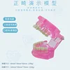 Normal orthodontic model pink