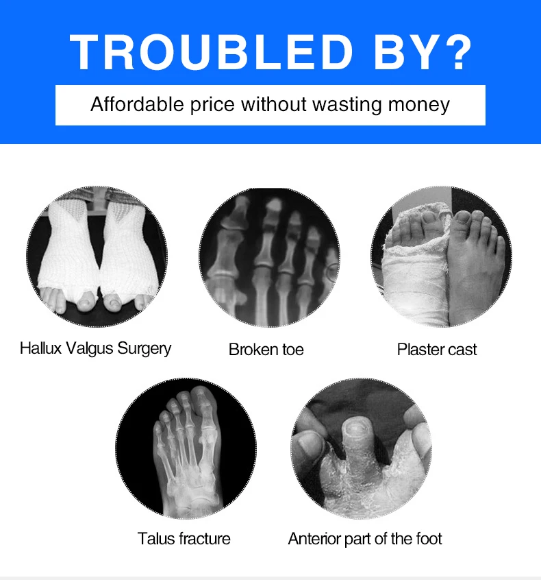 Medical Orthopedic Post Op Rehabilitation Therapy Surgical Operating ...
