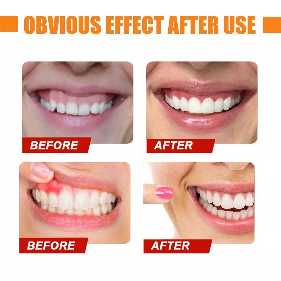 Teeth Paste (5).jpg
