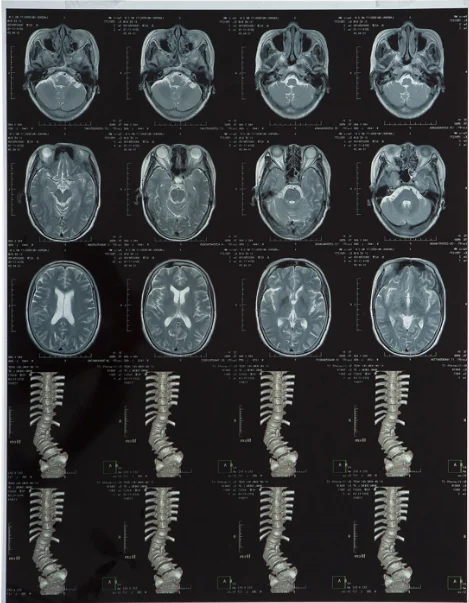 Hoge helderheid medische röntgenfilm FUJI DIHT 14*17in Laser Dry Imaging Film 0