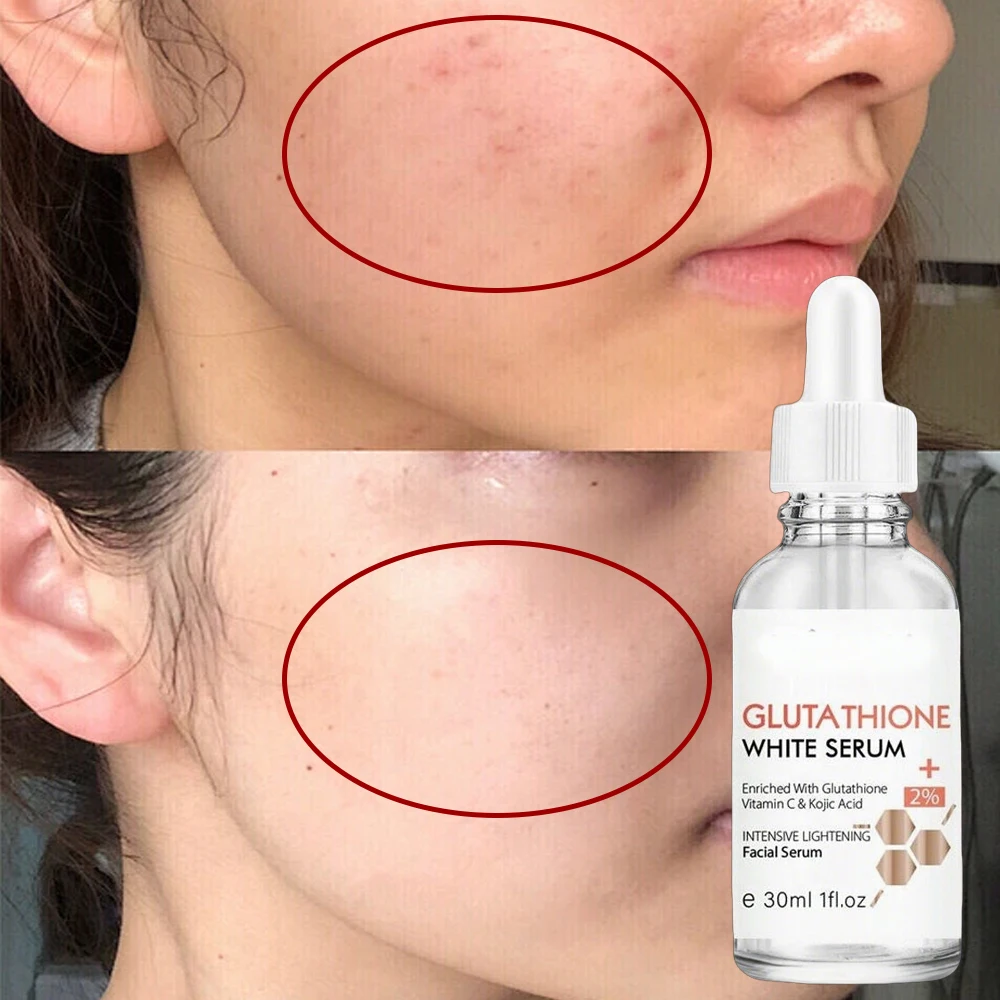 glutathione serum for skin whitening Fast Acting Brightening Women take B12 injections