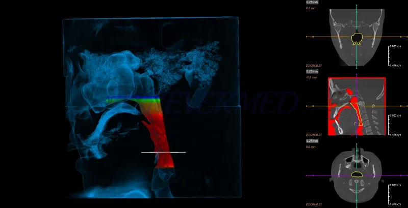 Dental Multi-function CBCT