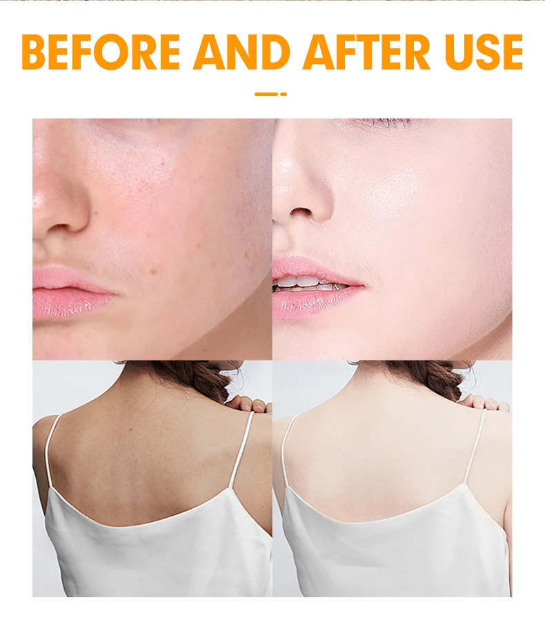 Salicylic Acid Uv Sunscreen Spray Spf 75 Sun Protection Moisturizer Oil Control Skin Glowing Sunscreen Face Mist Spray