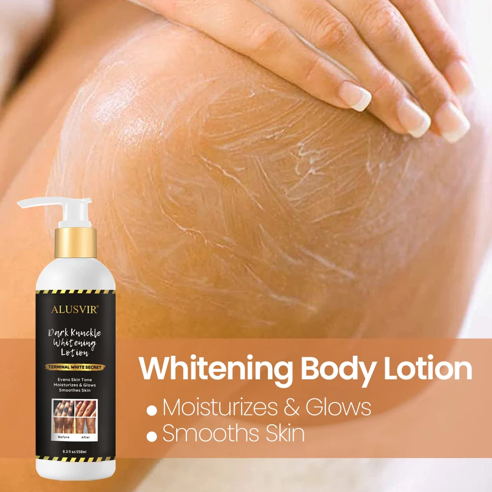 Wholesale Manufacturers Dark Knuckle Knees Remover Whitening Bleaching Serum Cream Body Lotion