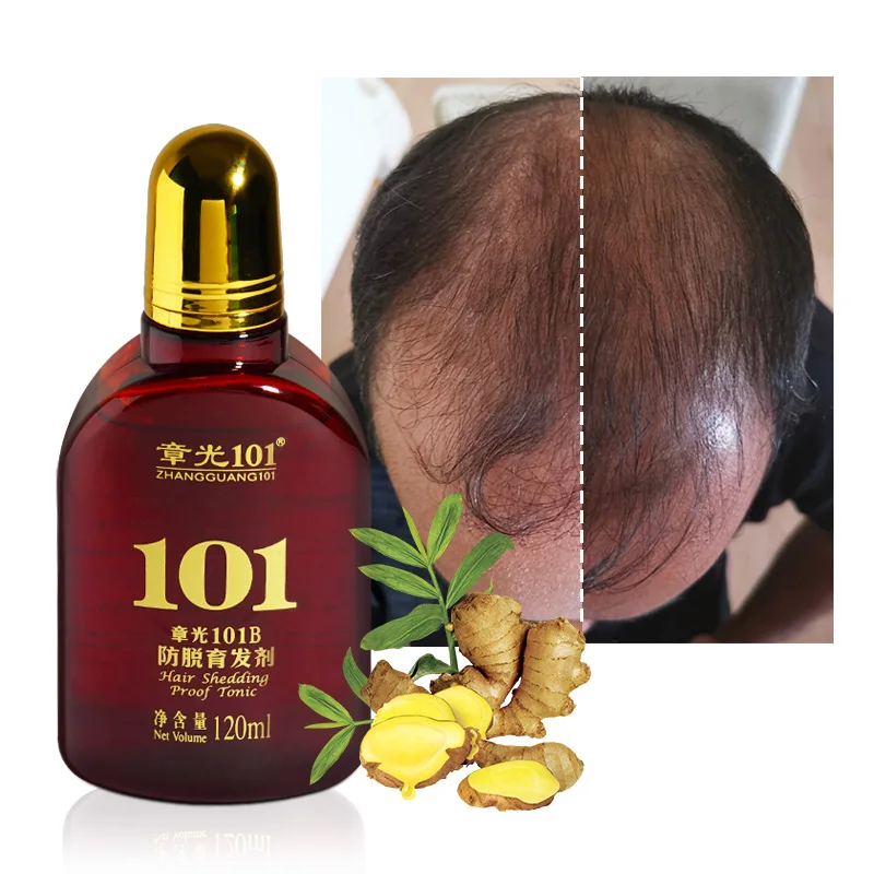 
 Высокое качество травяные ингредиенты натуральный Уход за волосами против выпадения волос сыворотка  