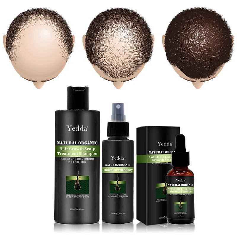 
Herbal Formula Effective Hair Growth Spray for Regrow Hair on Baldness Area 