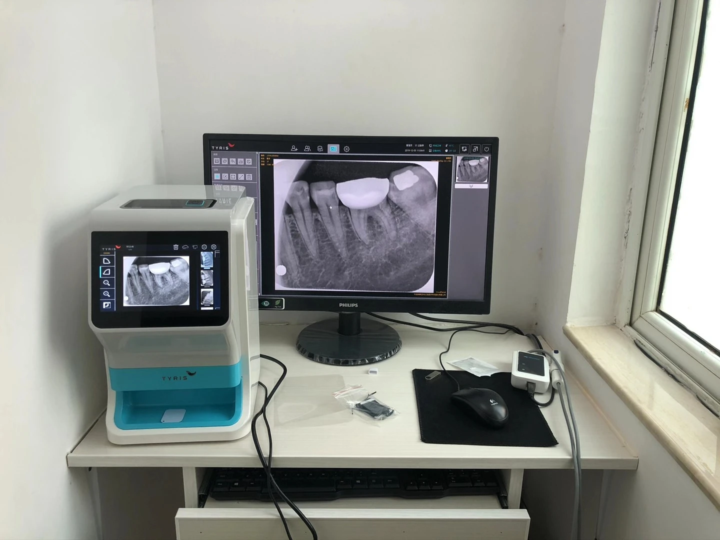 Tr310 2022 New Design Dental X Ray Film Scanner Price Buy Dental,Dental X Ray,Dental X Ray