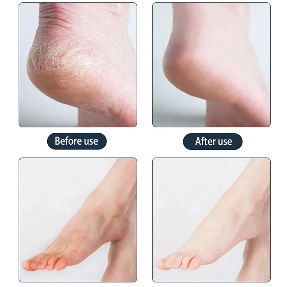 Custom Private Label Exfoliating Korean Type Foot Peeling Mask for Foot Care