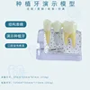 C dental implant through clear nail