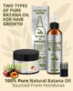 OEM hair growth oil