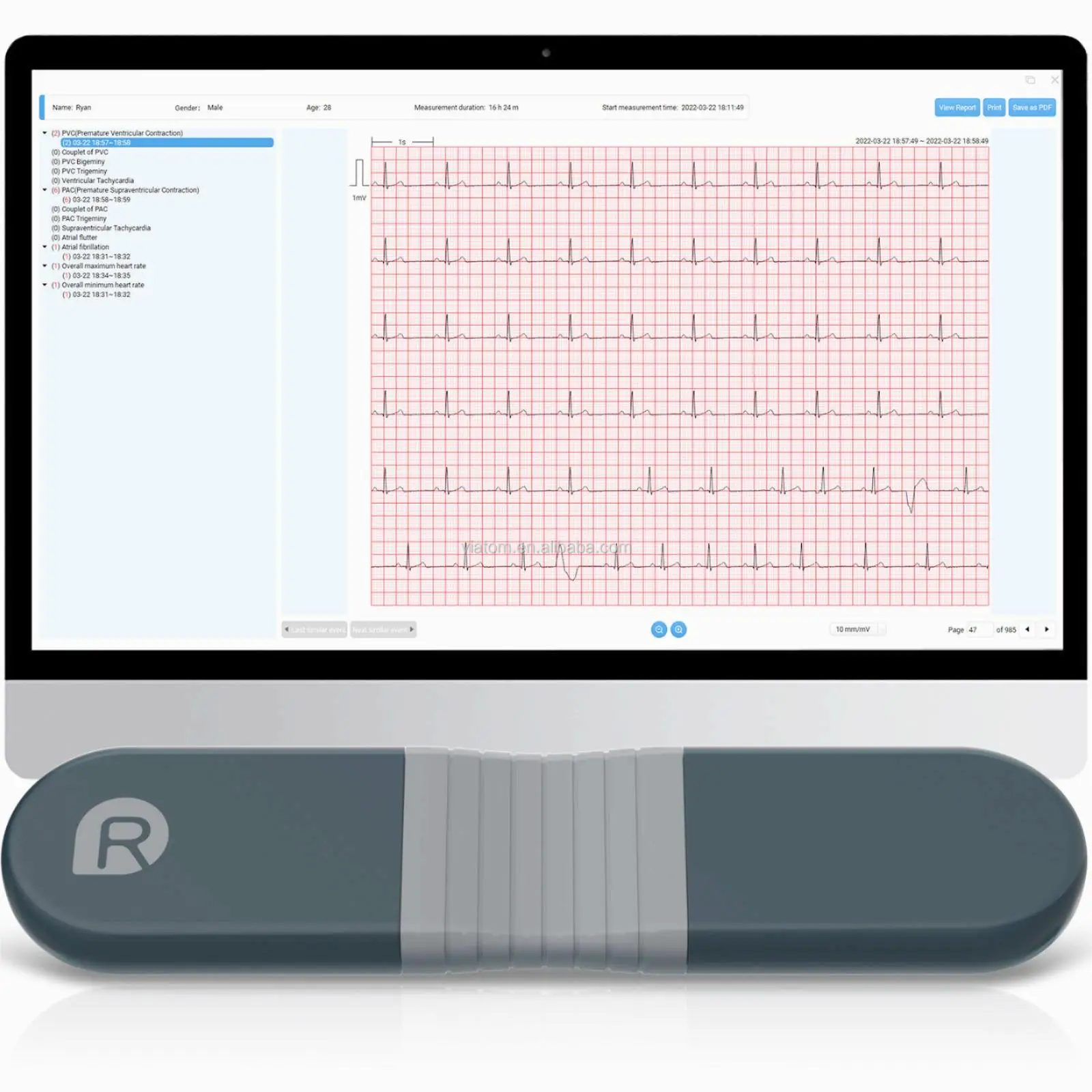 Medical ECG Patch Real-time Dynamic 72 HOURS ECG Recorder Wireless Bluetooth ECG Holter