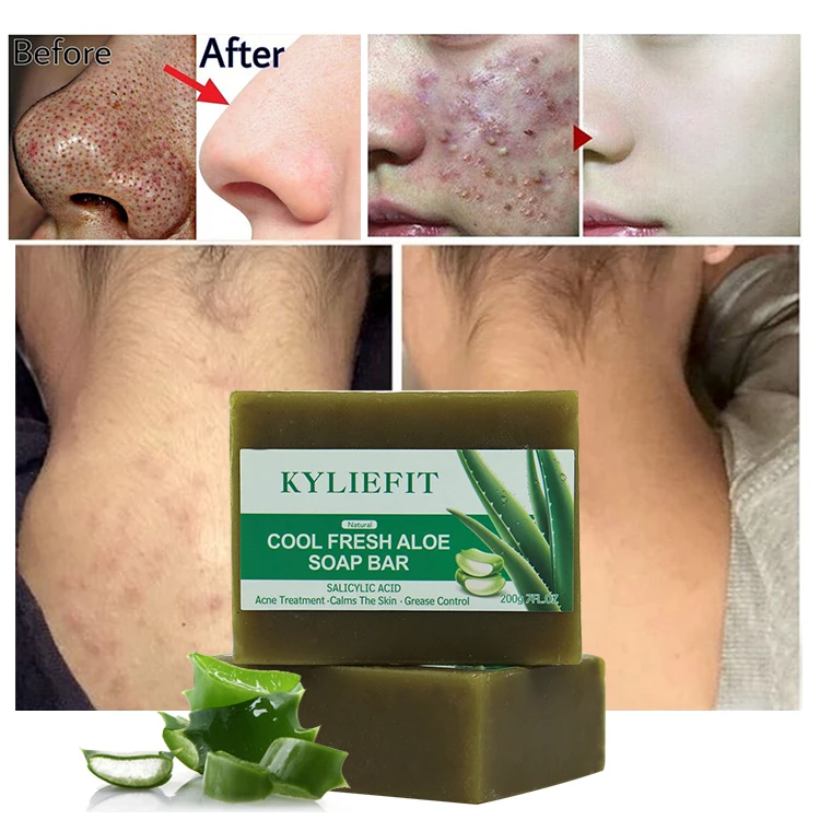 aloe vera haarausfall Curaloe Aloe Vera Shampoo main image 0