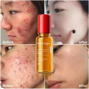 OEM ODM Korean Best Niacinamide Skin Care Cleansing Moisturizing Serums Shrink Pores Fade Acne Mark Removal Essence Face Serum