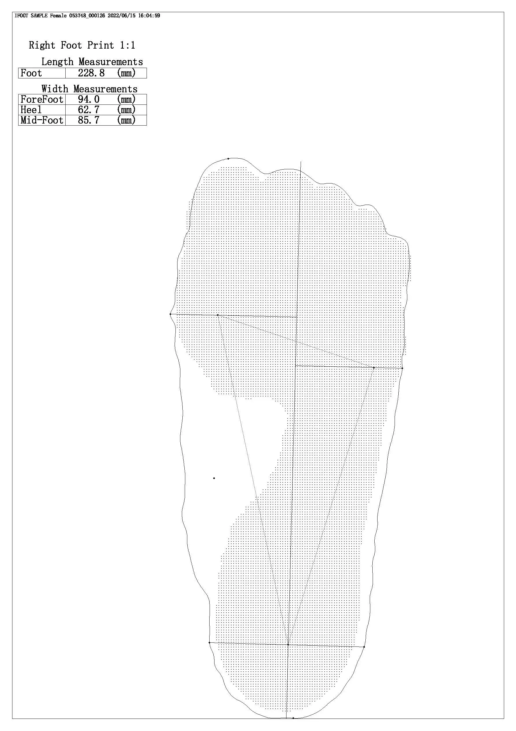 Isun3d 3d Foot Scanner With Multifunctions Can Scan Foam Box And Foot