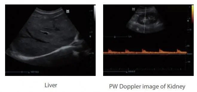 Mindray DP20 Portable Ultrasound Machine Price DP-20