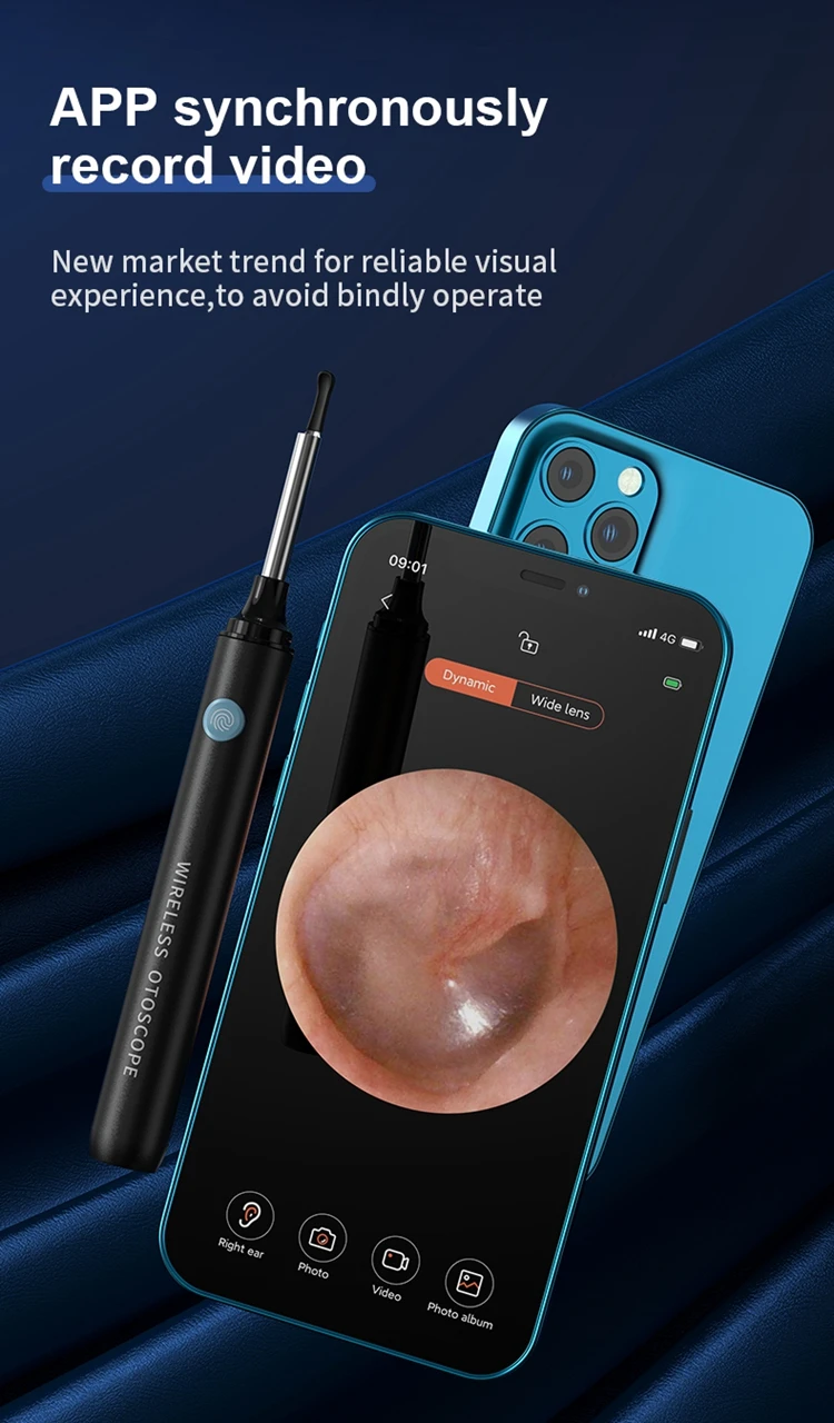 Ear Endoscope 4.jpg