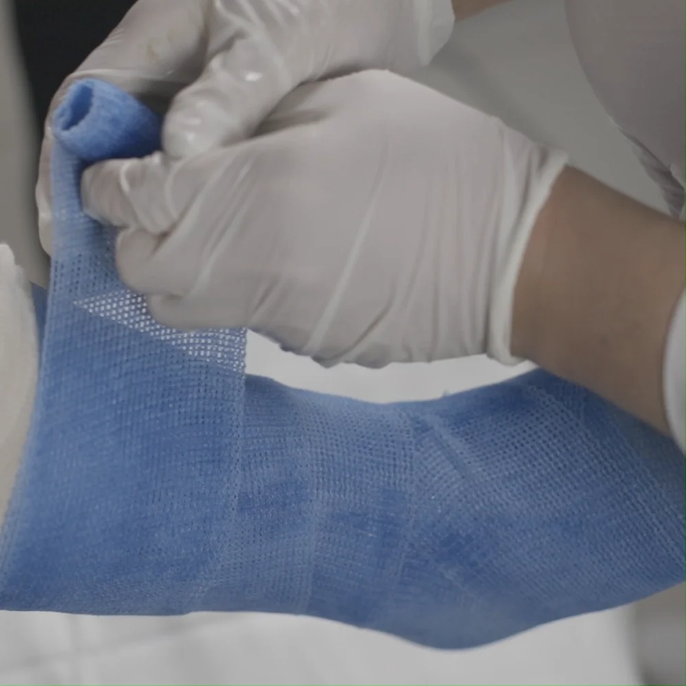 Medical Supplies Orthopedic Fiberglass Casting Tape Hospital Disposable