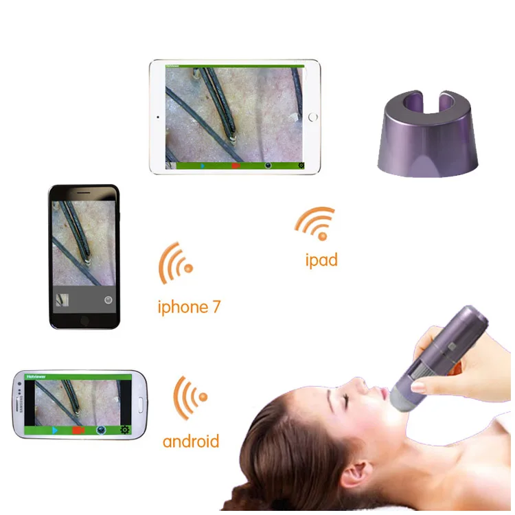 WIFI Smart Scalp Skin Detector инструкция. Детектор ai