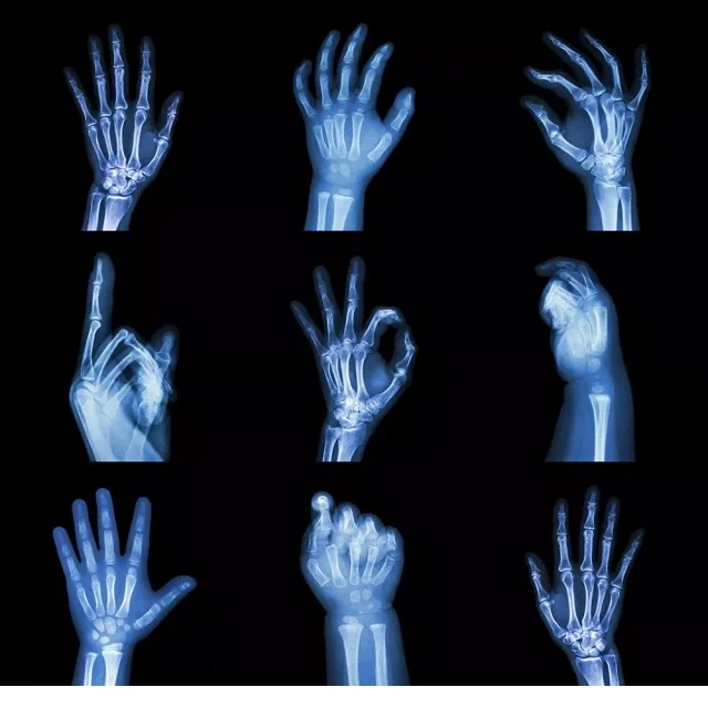 Inkjet blue printing medical x-ray film