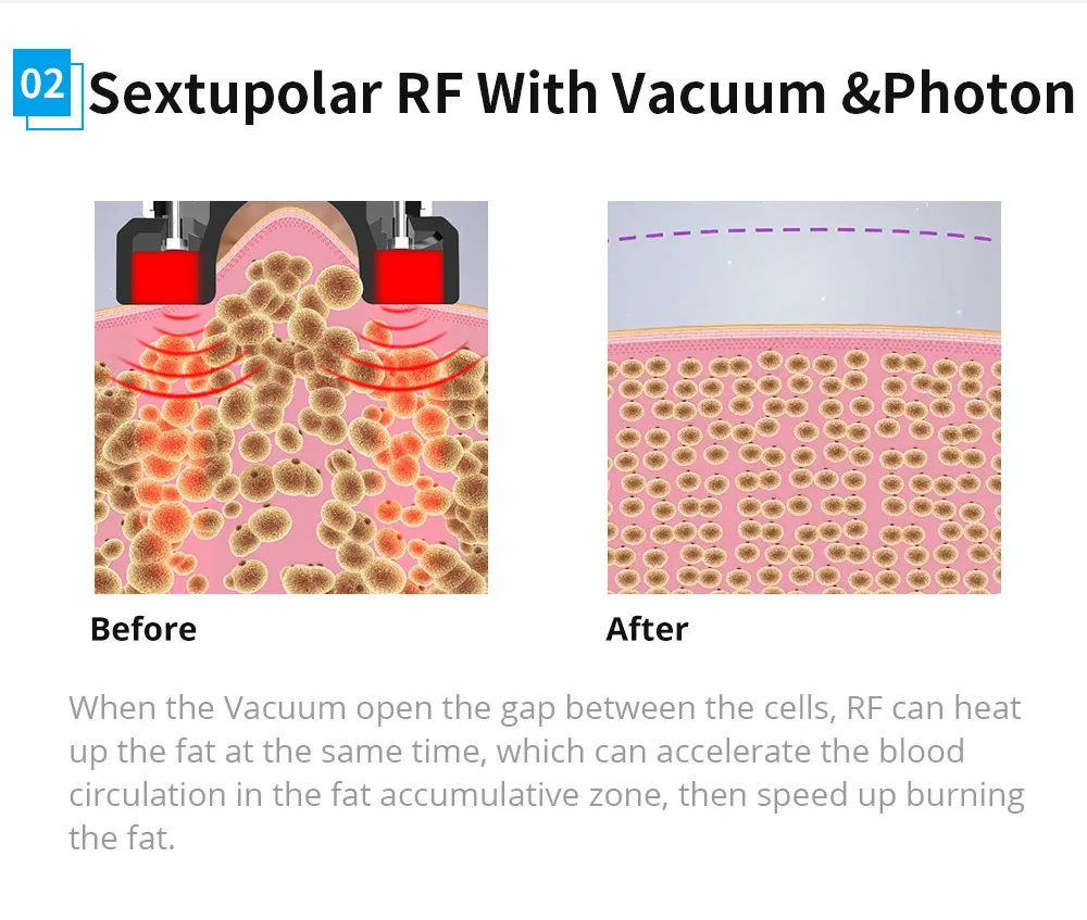 cavitation system body contour slimming removal vacuum cavitation rf body slimming machine