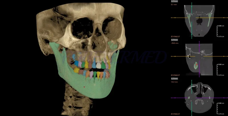 Dental Multi-function CBCT