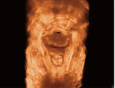 Sonoscape P20 Mobile 3D/4D Real-time Color Panoramic Doppler Trolley Ultrasound Machine factory