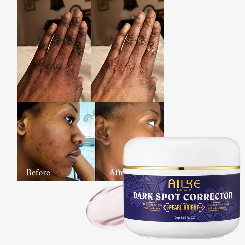 4 Arbutin Black People Brightening Face Body Glow Skin Whitening Cream For Black Women Buy Black Skin Whitening Cream Skin Whitening Cream For Black Women Skin Products For Black Women Product on