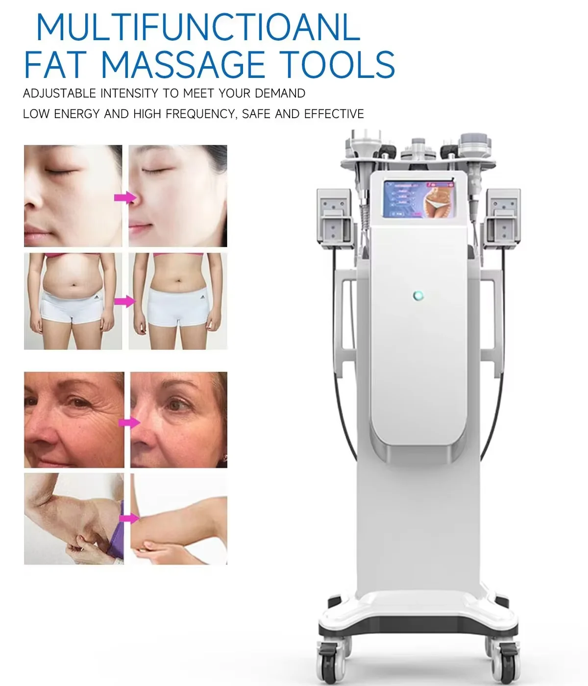 Professional 80K Cavitation Liposuction Machine 10-in-1 4 Discover the professional 10-in-1 80K cavitation liposuction machine with vacuum RF, lipolaser, BIO microcurrent, and multipolar RF technology for non-invasive body contouring and skin tightening treatments. Professional 80K Cavitation Liposuction Machine 10-in-1