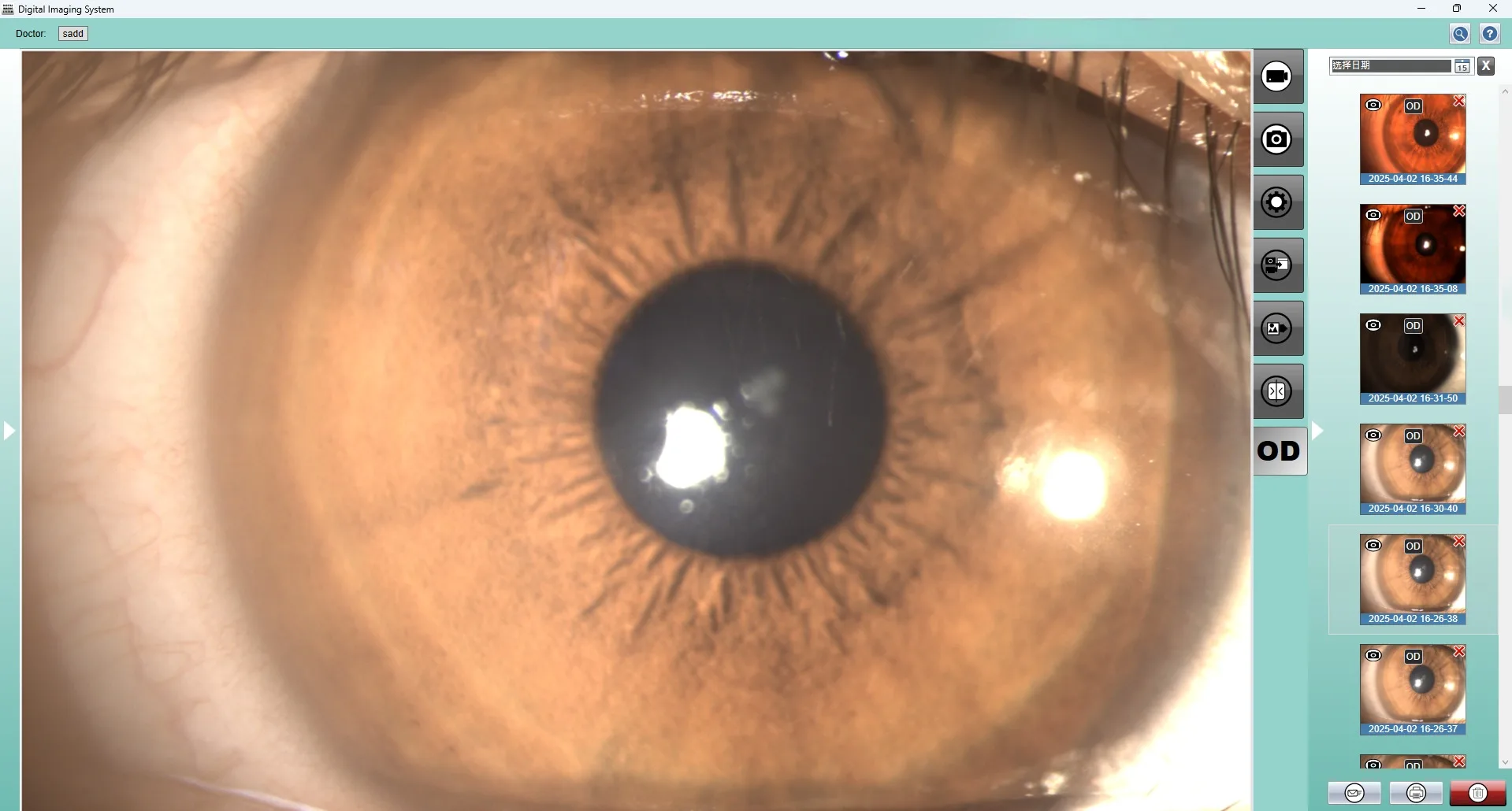 Digital Slit Lamp Imaging System for Slit Lamp Video Adapter with High Pixels for Clinical Ophthalmology Examinations