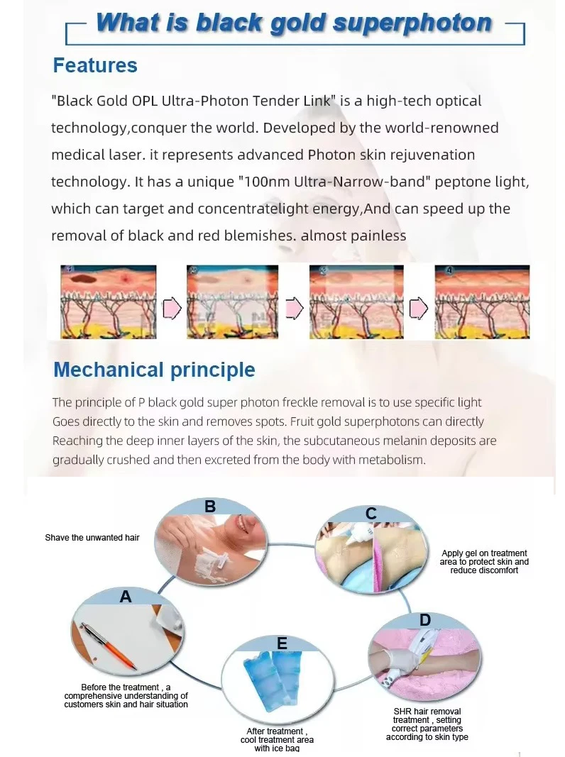 Discover the Black Gold DPL Ultra-Photon Skin Rejuvenation Device, a professional narrow-spectrum light platform designed for pigmentation correction, vascular therapy, acne treatment, and long-term hair reduction for aesthetic clinics and medical spas. Black Gold DPL Ultra-Photon Skin Rejuvenation Hair Removal Device