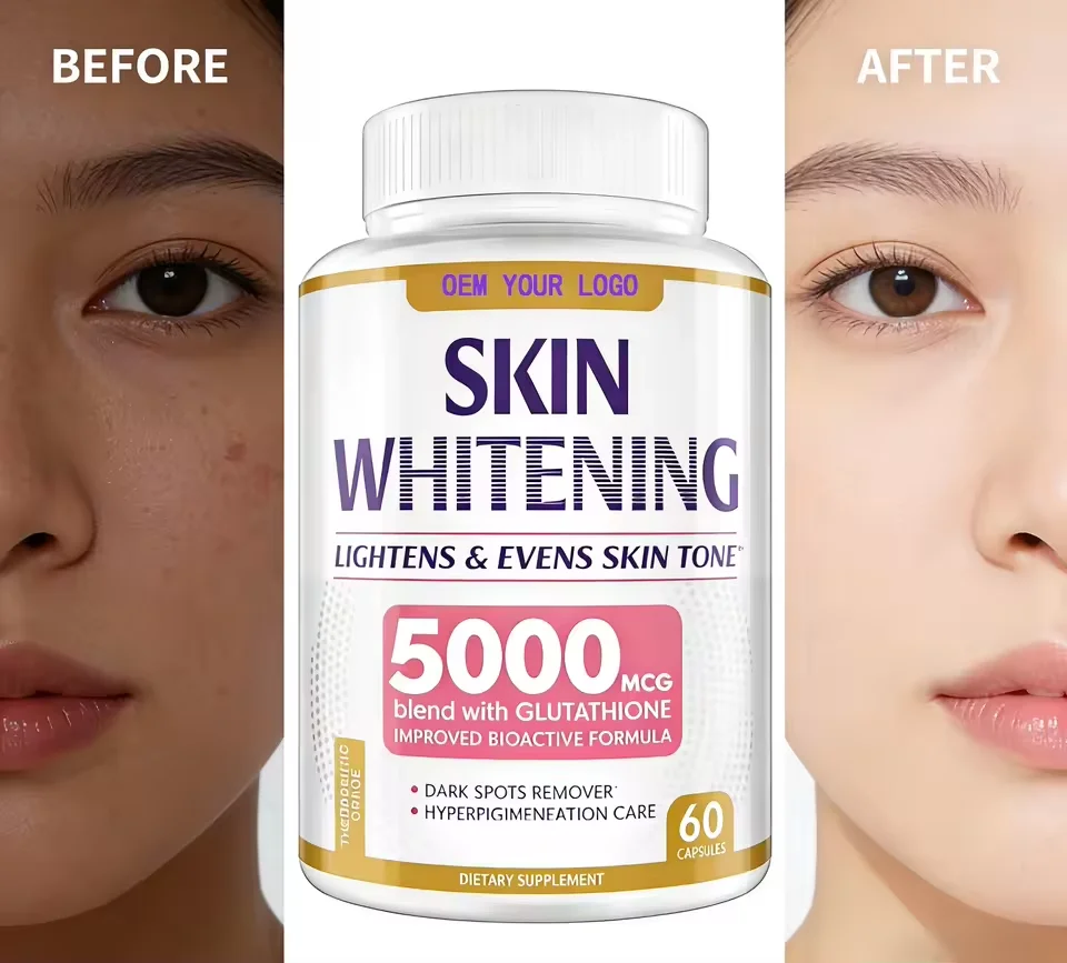 ishin premium glutathione ISHIN Advance White/ISHIN Premium Glutathione Plus Food Supplement Beauty Edible Fitness ishin premium glutathione ISHIN Advance White/ISHIN Premium Glutathione Plus Food Supplement Beauty Edible Fitness