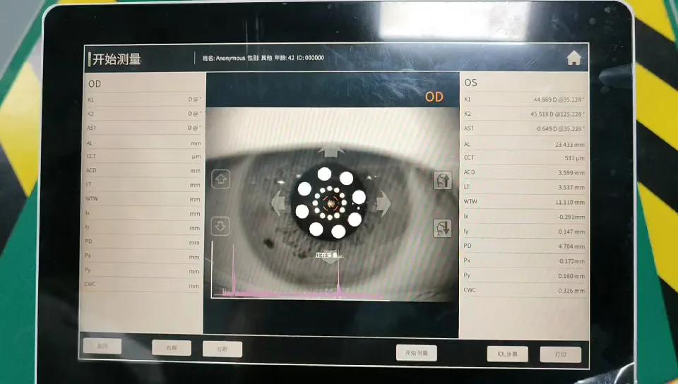 Alview Eye Exam Intraocular Lens Measurement Machine Optical Biometry