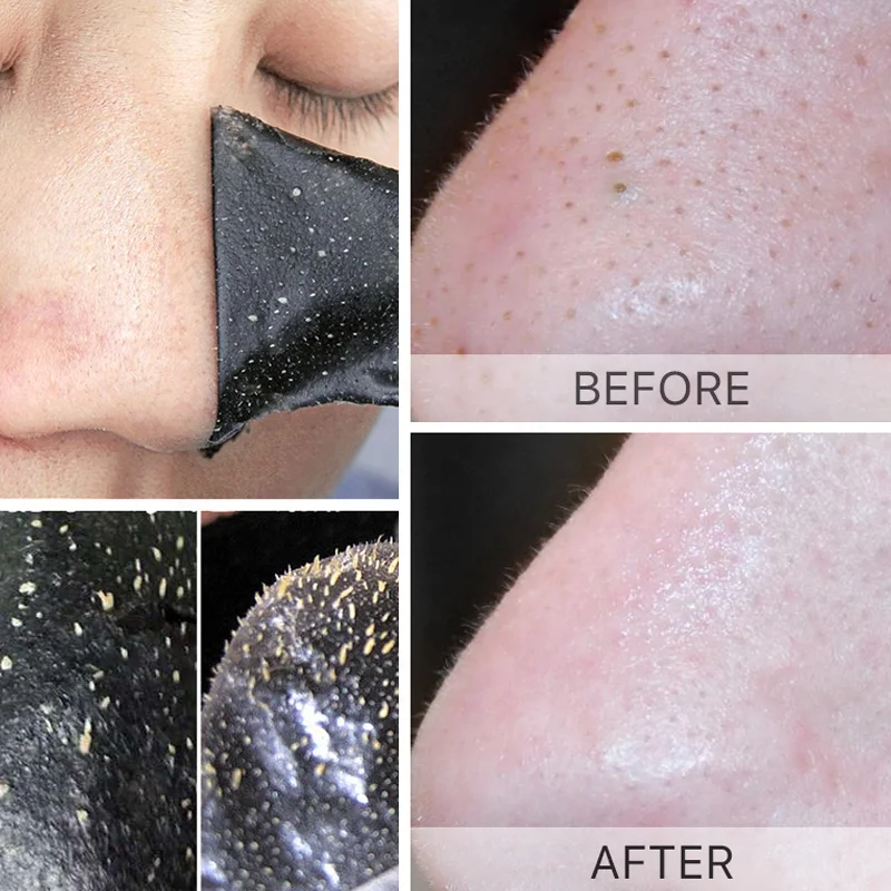 Индивидуальная фирменная лента для удаления черных точек на носу, уход за кожей, глубокое очищение, сужение пор, полоски для очистки носа