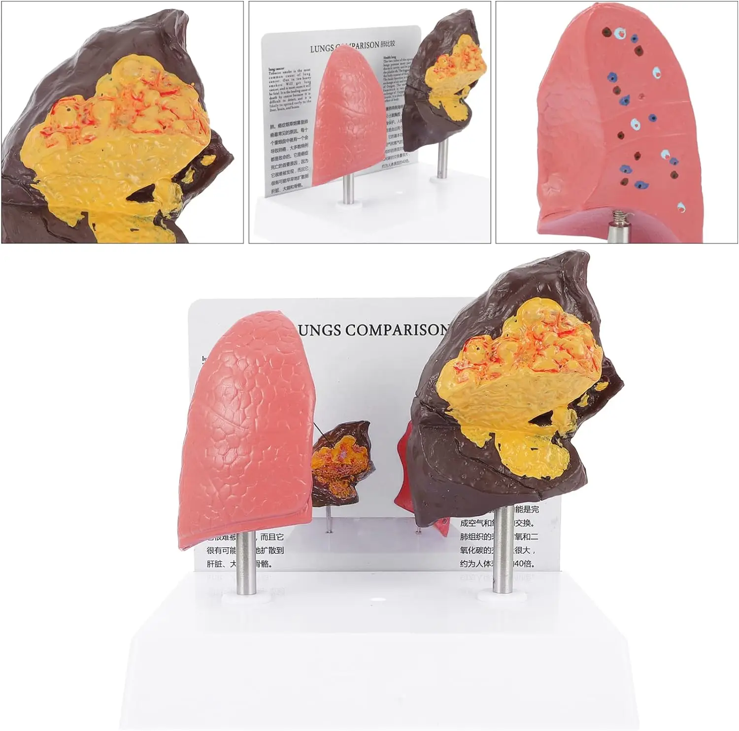 Medical Sciences Lung Contrast Model Health And Pathology Laboratory ...