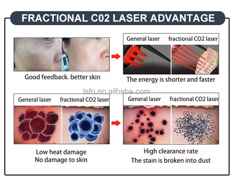 CE Approved l Tightening Facial Skin Rejuvenation RF Tube Fractional Co2 Laser Machine