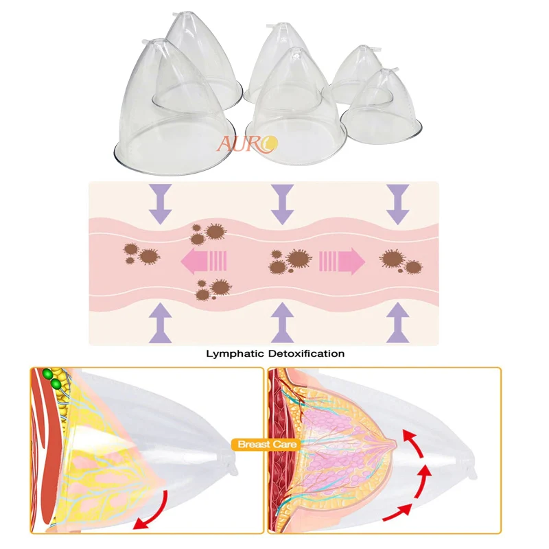 Hakuun Tubular Breast Normal Breast Vector Modern liittyvä