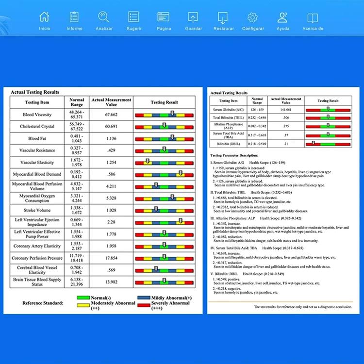 61 Checking Reports Quantum Resonance Magnetic Analyzer Healthy Analyzers Body Scanner Sub Health Diagnosis Machine