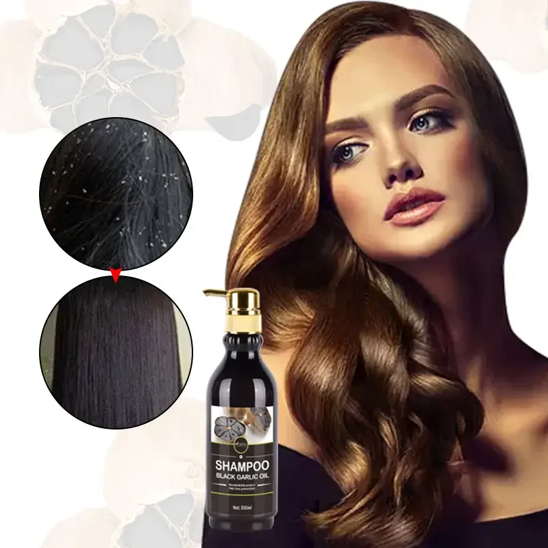 Wholesale MOKERU Natural Herbal Hair Loss Care Shampoo Keratin Anti Dandruff Black Garlic Shampoo and Conditioner for Women Men