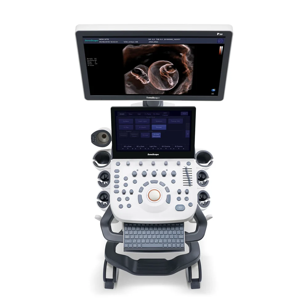 Sonoscape P20 Mobile 3D/4D Real-time Color Panoramic Doppler Trolley Ultrasound Machine