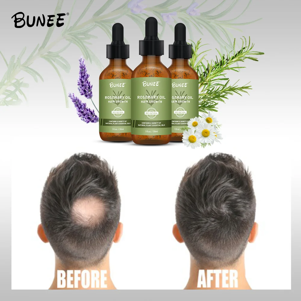 Huile De Romarin Pour La Barbe - Stimule La Pousse, 30ml, Naturelle, Soin Nourrissant Pour Homme