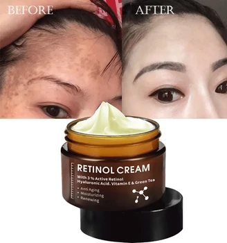High quality freckle cream Anti Aging Wrinkle Removal Dark Spot Strong bleaching whitening Collagen retinol vitamin c face cream