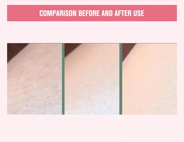 Imported 2022 Top Sales Personal Care Device High Power Upper Lip Hair Body Hair Woman Mini