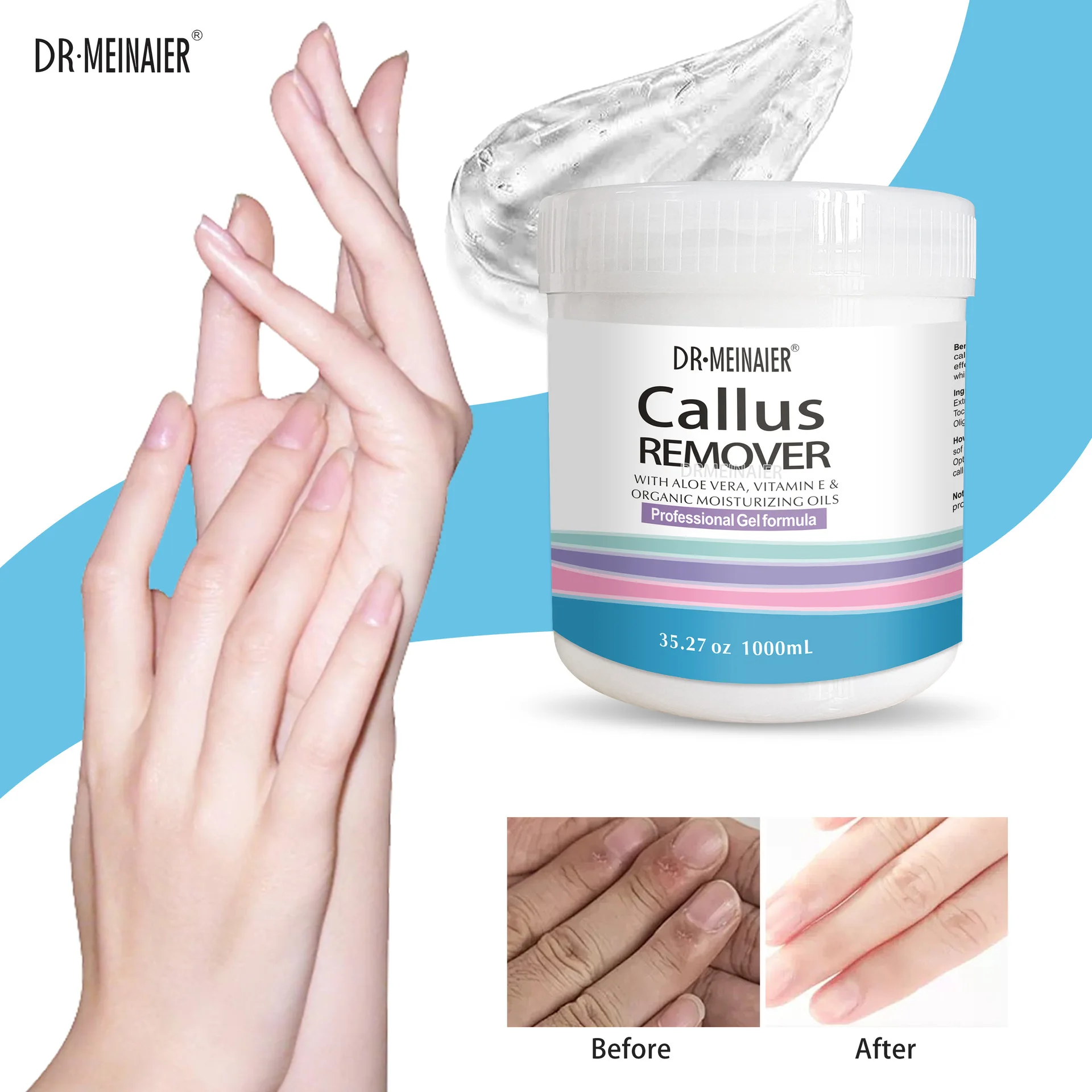 Hochwertiges 1L Professionelles Fu- und Hand-Peeling-Gel mit Organischem  Aloe-Extrakt, Vegan, Kruterbasiert, Feuchtigkeitsspendend, Fersen-Schutz  gegen Hornhaut