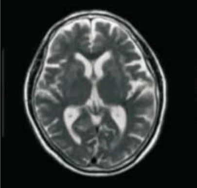 Hospital Medical Magnetic Resonance Imaging System 1.5T  MRI Machine with A-combi and Al Technologies supplier